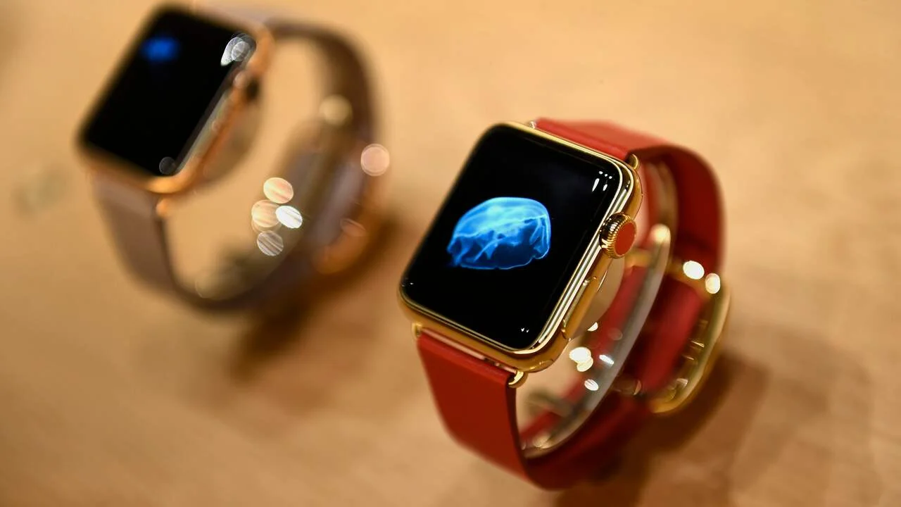 Apple Watch was used by veterinarians to perform surgery on a lion